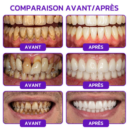 Dentifrice thérapeutique Rolimey® VioCore au venin d’abeille contre la gingivite et la parodontite