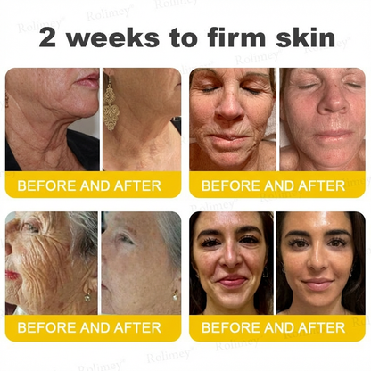 Wrinkle-Lift⬆️ Botox & Vita A Retinol Shot Tightening cream