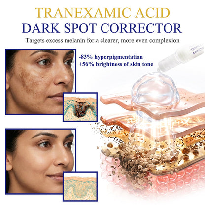Novalorocosh® Tranexamic Acid & Golden Vitamin C Brightening Anti-Aging Serum